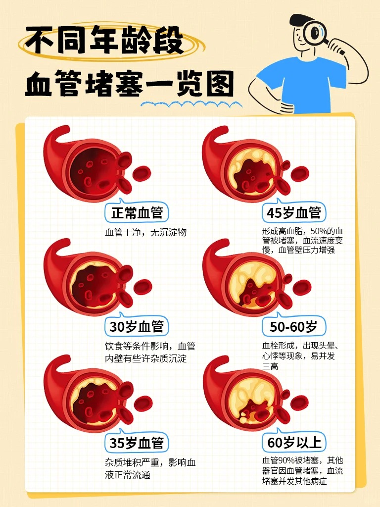 【10月13日世界血栓日特辑】。血管，是身体里奔流的“生命河流”。。警惕这些“河道淤堵”信号：头晕乏力、胸闷心悸、记忆断片…。尤其30岁后，代谢减慢，“垃圾”易沉积，养护必须趁早！。金木健康提醒：健康饮食+适度运动+定期检测，远离血栓风险！